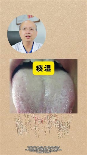 中医教你如何看舌辨症 #中医 #推薦 #科普#粤语