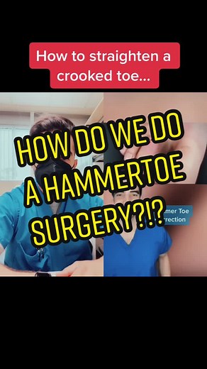Straightening Toe Nails: A Guide to Hammertoe Surgery
