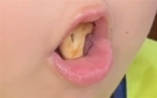 【ASMR】宝宝版吃播、声控解压。哈哈哈