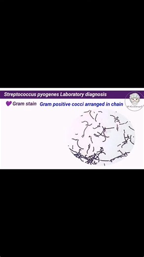جزء من محاضرة #streptococcus_pyogenes❤️💥 تقدر تتابع كل جديد عن علم الميكروبيولوجي من خلال قناة #الميكروبيولوجيست علي اليوتيوب. الكورس التأسيسي من الصفر في الميكروبيولوجي من خلال الرابط التالي 👇 https://youtube.com/playlist?list=PLgvGlmRQNyHzY1JapmHkQIKSLakWp5wRb&si=Q_JY9WqGcEduhrhF و اكتر من ٥٠ محاضرة مجانية #Advanced في علم Medical Microbiology من خلال الرابط التالي 👇 https://youtube.com/playlist?list=PLgvGlmRQNyHwNBw5el7otnXgc4qENbeUq&si=jI04jNO3Ix0nyHMg #الميكروبيولوجيست د. أحمد مصطفى | El