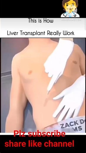 liver transplantation function #shortsfeed #youtubeshorts #shorts