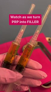 BIO-FILLER GEL. Used to augment fine lines and wrinkles as well as to give definition to different areas of the face and body 🍑💙Bio Filler is made by separating and processing the plasma from patient’s own blood and in then, injecting it to volumise, lift, and rejuvenate. Bio Filler has the same color and form as autologous fat.💙#regenerativemedicine #prp #biofiller #bbl #noninvasivebbl #naturalfiller #prpinjections #prpundereye #prpbuttlift #prpfacial | Roni Bolton