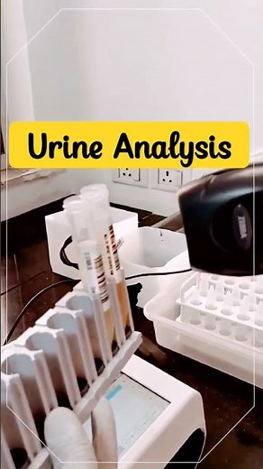 UC-1000 Sysmex || Urine Analyzer