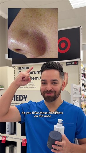 Sebaceous filaments hack! | sebaceous filaments