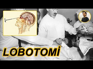 Lobotomi ve Karanlık Tarihi ( Karanlık Bilim #13 )
