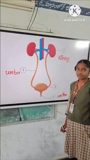 #Label parts of kidneys #Biology #kidneys #slowlearners #activity
