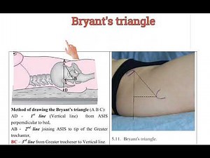 How to draw Bryant's triangle