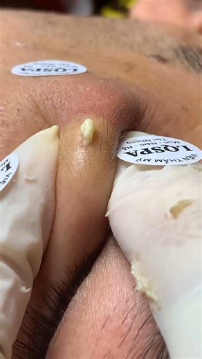 Scienceiot on Instagram: "Proskire Vitamin C serum के बारे में आपकी जानकारी सही है कि Vitamin C सीरम का उपयोग त्वचा पर करने से मेलानिन के स्तर को कम करने में मदद मिल सकती है। इससे त्वचा का रंग हल्का हो सकता है और त्वचा पर निखार आ सकता है। *available in amazon & flipkart #science #biology #education #physics #technology #research #chemistry #space #engineering #nature #art #astronomy #nasa #stem #scientist #facts #knowledge #medicine #love #health #universe #sciencefacts #math #memes #learning #n