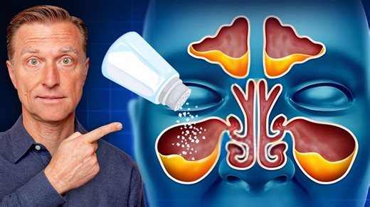 686K views · 16K reactions | Discover how to get rid of mucus in your throat using one ingredient: salt! If you like this video, check this one out next: https://drbrg.co/42N53tK | Dr. Eric Berg | Facebook