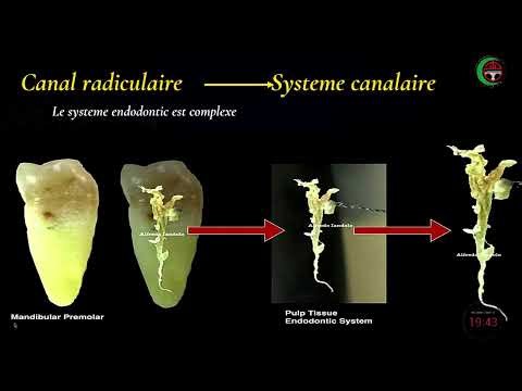 Professor LAIZ A: Mastering 3D Root Canal Obturation