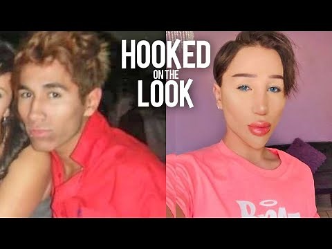 I've Had 30 Procedures - On My Face | HOOKED ON THE LOOK