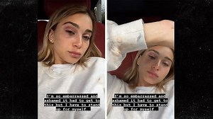 Tyga's Ex-GF Shows Bruises After Claims That He Got Physical