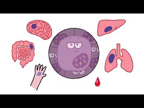IDH Inhibitors for Cholangiocarcinoma