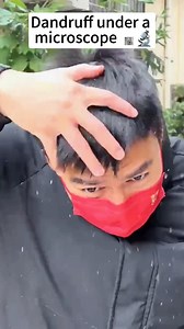 Dandruff at 400X looks so cool! #microscope #dandruff | Mir Glazami Microscopa