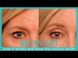 What is a Brow Lift? How It Works and What You Should Know