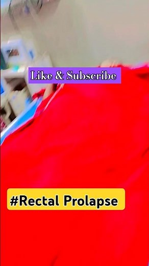 Rectal Prolapse Surgery: What You Need to Know