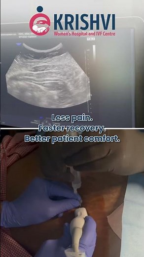 TAP Block Explained: Ultrasound-Guided Anesthesia for Pain-Free Recovery | USG TAP Block