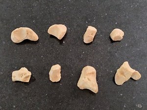 Carpal Bones - Identification