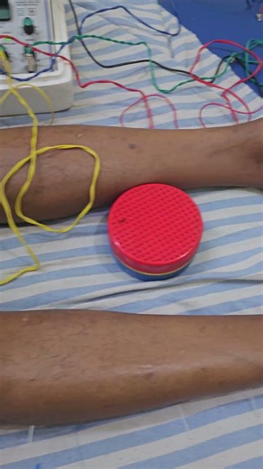 Stroke Rehabilitation Program by Dr Shashikant at Divine Grace Hospital