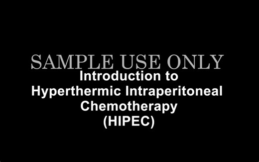 【癌症治疗】2 腹膜内加热化疗 HIPEC (Heated Intraperitoneal Chemotherapy)