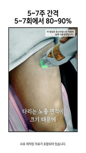 남자 팔다리제모 꾸준한 관리로 길쭉쭉 효과까지?⚡ #shorts #레이저제모