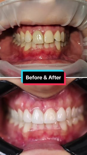 Transform Your Smile with Aesthetic Dental Institute