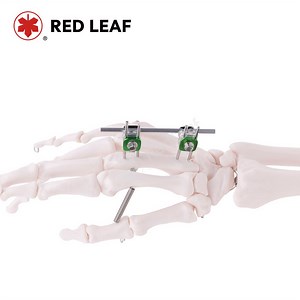 [Hot Item] Premium Combination Finger Palm External Fixator for Orthopedic Use
