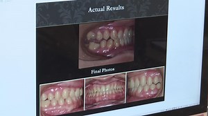 'Zoom dysmorphia' leading people to seek dangerous DIY remedies for their smile