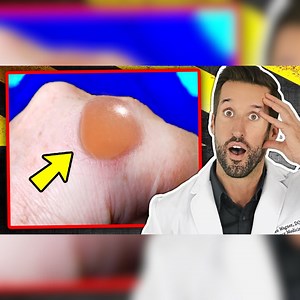 10 Bizarre Body Signs You Shouldn't Ignore | Doctor ER