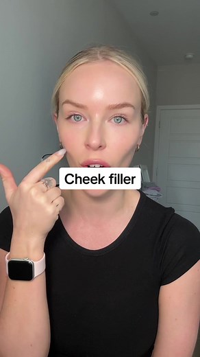 Cheek filler is the BEST when in the right hands. I love taking a conservative approach & safely enhancing your natural anatomy 🫶🏼 #cheekfillerphoenix #cheekfillerbeforeandafter #phoenixinjector #arizonainjector #phoenixmedspa DISCLAIMER these videos are meant for educational purposes only. I am not recommending or suggesting you seek these treatments. These treatments are to be performed by licensed medical professionals only and could pose serious risks.