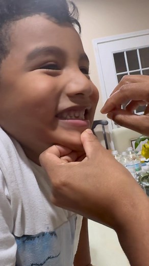 El pequeño Emir mudando su 2do diente😬 # Hashtag | Yoanna Merlin