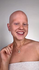 45K views · 36K reactions | WHO WANTS TO SEE THE TRANSITION???? Also my shoe collection drops on my birthday 9/26!!!! The link is in my bio 拾 #alopecia #makeup #heels #autoimmune | Emmy Combs | Facebook