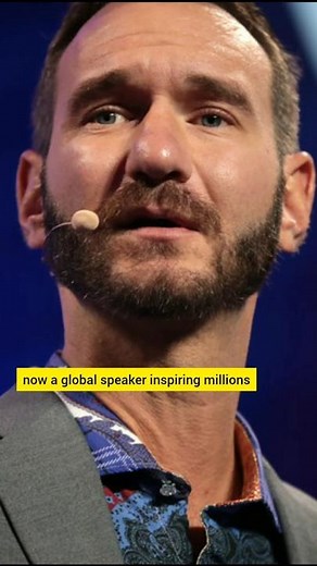 Limitless Life: Overcoming Challenges with No Limbs by nick vujicic @nickvujicic