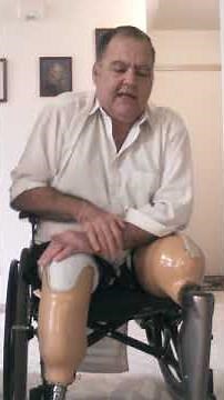 102 Easy way to put on stuck below the knee prosthetic pin system dbl amp