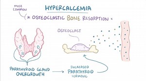 Video: Hypercalcemia - Video Explanation! | Osmosis | Osmosis