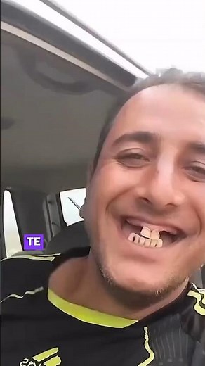 How to replace all your teeth even if you don't have much money. Here I explain all the options.