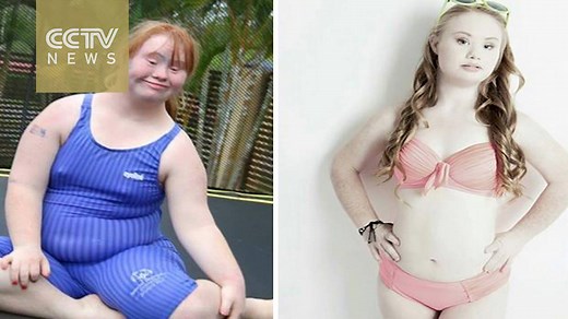 Madeline Stuart: Meet the inspiring model with Down syndrome Madeline Stuart is an 18-year-old Australian teen with dreams of becoming a model. While it’s a dream not unlike many of her peers, Stuart is unique because she has Down syndrome. With every move she makes in her modeling career, she is smashing down barriers. | CGTN