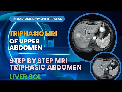 Mastering MRI Triphasic Abdomen; What you need to know | MRI Triphasic Upper Abdomen | Triphasic MRI