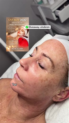caption: ⸻ ✨ Trine er vinderen af giveaway ✨ Hun var til sin allerførste behandling hos mig i The Facial Lounge 💛 Hendes hud havde brug for lidt ekstra kærlighed — den var meget tør, manglede fugt og havde både pigmentering og fine linjer. Hun fik en kombination af diamantslibning og DermaOxy-behandling samt fugtmaske, øjenmaske, håndmassage og hovedbundsmassage. Hele behandlingen varede 75 minutter ✨ Tak, Trine — jeg håber, du havde en skøn oplevelse, og at din hud fik det, den havde brug for 