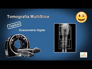 Escanometria Digital por Tomografia