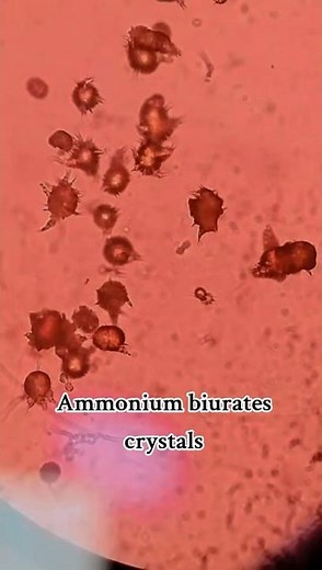 Ammonium biurates crystals