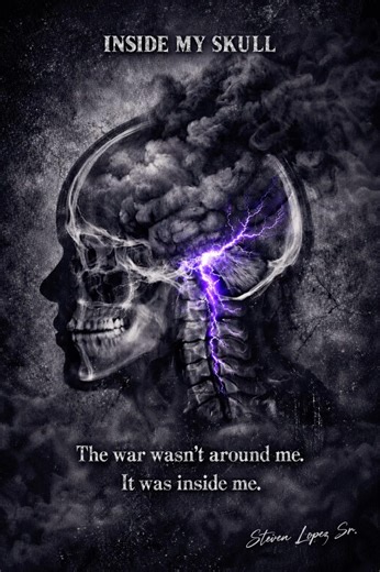 Chiari Malformation and Syringomeylia. #chiarimalformation #chiari #awarness #chronicillness