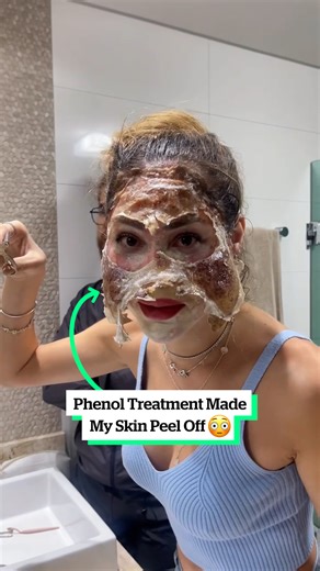 My skin is falling out in chunks😰📹luannacharamba | VT