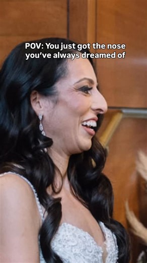 Quatela Center for Plastic Surgery Rochester NY on Instagram: "A transformation that still has us in awe ✨ This beautiful patient is just over 1.5 years out from her rhinoplasty with Dr. Quatela, and her results are speaking volumes. We love when patients share their updated photos - nothing better than seeing their confidence shine through!"