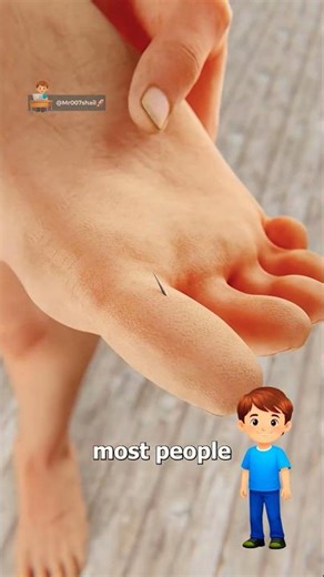 How Suction Removes A Deep Splinter! 💉🤔 | Facts | Shorts |