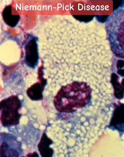 Clinical and Chemical Pathology. From Basics to Advances on Reels