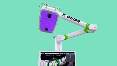 X-Guide® | Nobel Biocare