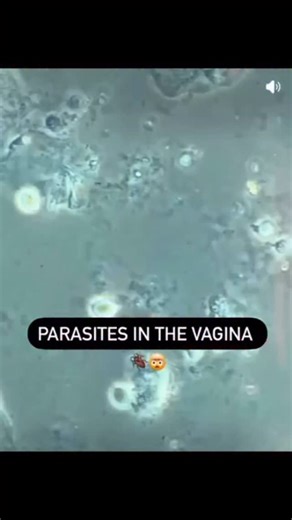 434 reactions · 15 shares | Specific parasites in the vagina and...