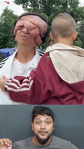 SLANDER - Love Is Gone | Disable Man #shorts#humanity#viral#emotional#sad#tiktok