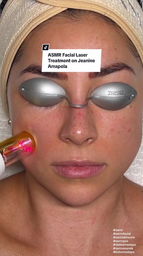 ASMR Facial Laser Treatment For Pigmentation Removal